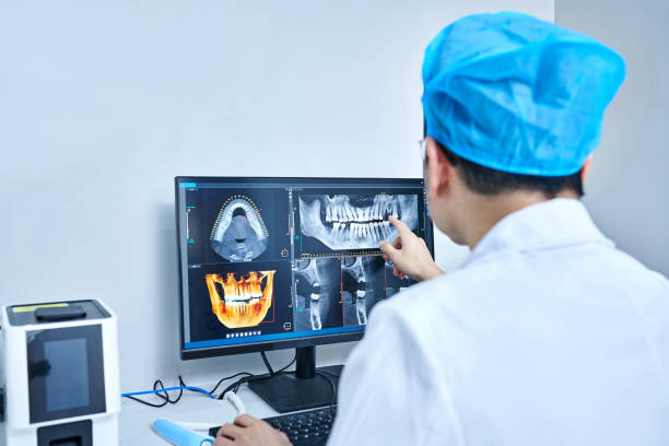 Best Emergency Wisdom Tooth Extraction in New Hempstead, NY