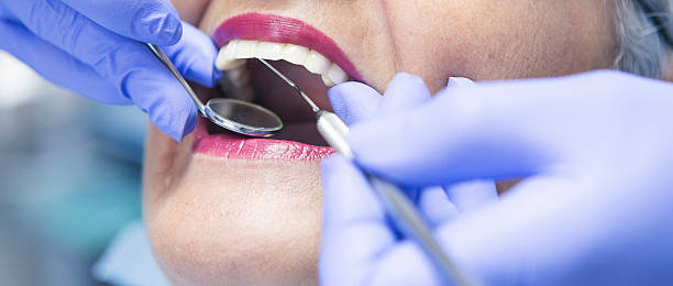 Best Emergency Wisdom Tooth Extraction in New Hempstead, NY